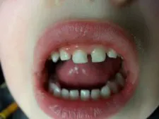 Heroic Dent Leigh03 Heroic Dent Leigh03