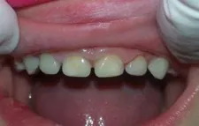 Heroic Dent Leigh04 Heroic Dent Leigh04