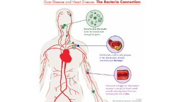 Content Dam Diq Online Articles 2017 02 17feb2bcgregg Thumb