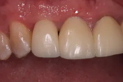 17mar2bcmeek P05 17mar2bcmeek P05