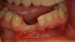 17mar2bcpaghdiwala P01 17mar2bcpaghdiwala P01