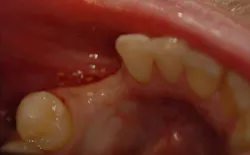 17mar2bcpaghdiwala P02 17mar2bcpaghdiwala P02