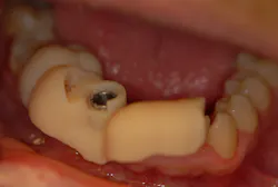 17mar2bcpaghdiwala P06 17mar2bcpaghdiwala P06