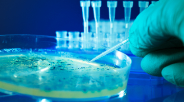 Content Dam Diq Online Articles 2017 02 Bacterial Colonies Dreamstime Thumb