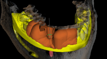 Content Dam Diq Online Articles 2017 03 17mar2bcpaghdiwala Thumb