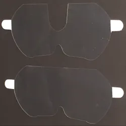 Pmm Loupesaver Fig01 Pmm Loupesaver Fig01