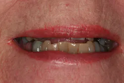 17may4bcwych P03 17may4bcwych P03