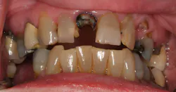 17may4bcwych P04 17may4bcwych P04