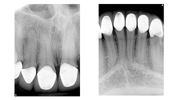 Content Dam Diq Online Articles 2017 05 17may4bcednote Thumb