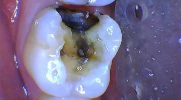 Content Dam Diq Online Articles 2017 05 17may4bcweintraub Thumb