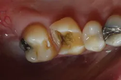 Dexis 05172017 Ar4 Picture3 Dexis 05172017 Ar4 Picture3