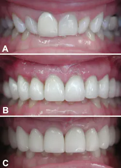 Fagin Temps02 Fig10 Fagin Temps02 Fig10