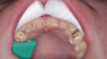 Content Dam Diq Online Articles 2017 08 17aug3bcjohnson Thumb