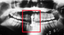 Content Dam Diq Online Articles 2017 08 Jeong X Ray 1 Content Dam Diq Online Articles 2017 08 Jeong X Ray 1
