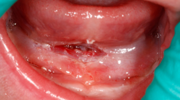 Content Dam Diq Online Articles 2017 09 17sept7bcweintraub Thumb