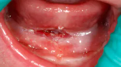 Content Dam Diq Online Articles 2017 09 17sept7bcweintraub Thumb Content Dam Diq Online Articles 2017 09 17sept7bcweintraub Thumb