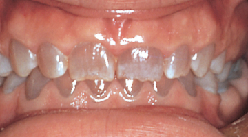 Content Dam Diq Online Articles 2017 11 Jeong Thumb