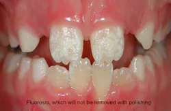 Jeong Polishing Jeong Polishing