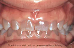 Jeong Polishing 1 Jeong Polishing 1