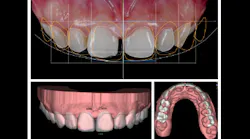 Content Dam Diq Online Articles 2017 12 Digital Smile Design Diqthumb Content Dam Diq Online Articles 2017 12 Digital Smile Design Diqthumb