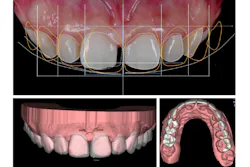 Digital Smile Design Fullsize Digital Smile Design Fullsize