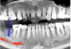 Troubleshooter 4 Troubleshooter 4