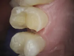 18jan25bcganci01 18jan25bcganci01