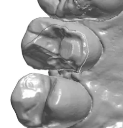 18jan25bcganci02 18jan25bcganci02