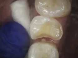 18jan25bcganci03 18jan25bcganci03