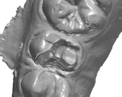 18jan25bcganci04 18jan25bcganci04