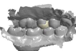 18jan25bcganci07 18jan25bcganci07