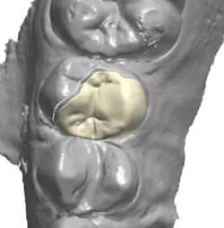 18jan25bcganci09 18jan25bcganci09