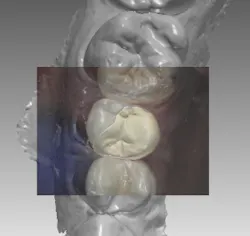 18jan25bcganci10 18jan25bcganci10