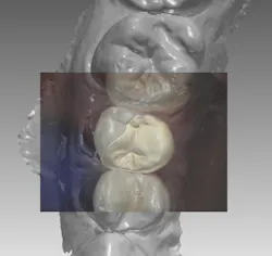 18jan25bcgancitop 18jan25bcgancitop