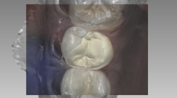 Content Dam Diq Online Articles 2018 01 18jan25bcgancit