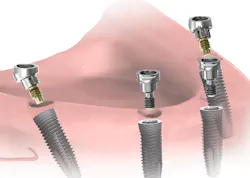 18jun28bchodges07 18jun28bchodges07