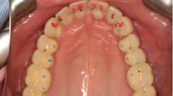 Content Dam Diq Online Articles 2018 06 18jun28bcspringert Content Dam Diq Online Articles 2018 06 18jun28bcspringert