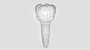 Content Dam Diq Online Articles 2018 07 Dental Implant Sales Tools Diqthumb