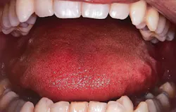 18aug23bcwilkerson03 18aug23bcwilkerson03