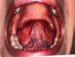 18aug23bcwilkerson07 18aug23bcwilkerson07