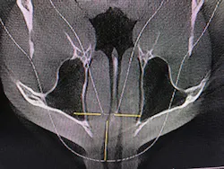 18aug23bcwilkerson08 18aug23bcwilkerson08