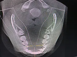 18aug23bcwilkerson09 18aug23bcwilkerson09