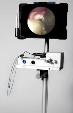 Fortune Wedpnae Endoscope Fig00 Fortune Wedpnae Endoscope Fig00