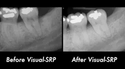 Content Dam Diq Online Articles 2018 09 Fortune Endoscopy Casereview Diqthumb 03 Content Dam Diq Online Articles 2018 09 Fortune Endoscopy Casereview Diqthumb 03