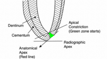 Content Dam Diq Online Articles 2017 01 17jan5bcdeutsch Thumb