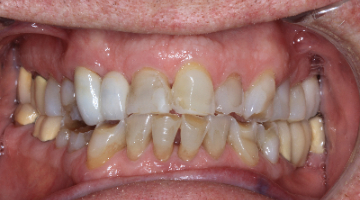 Content Dam Diq Online Articles 2017 01 17jan5bcednote Thumb