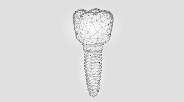 Content Dam Diq Online Articles 2019 02 Dental Implant Abstract 360x200