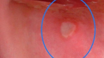 Content Dam Diq En Articles 2019 01 8 Steps For Documenting Oral Lesions Leftcolumn Article Thumbnailimage File
