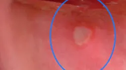 Content Dam Diq En Articles 2019 01 8 Steps For Documenting Oral Lesions Leftcolumn Article Thumbnailimage File Content Dam Diq En Articles 2019 01 8 Steps For Documenting Oral Lesions Leftcolumn Article Thumbnailimage File