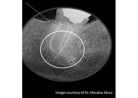 Content Dam Diq En Articles Slideshows 2014 12 Dental Photo Of The Day 06 Leftcolumn Article Thumbnailimage File